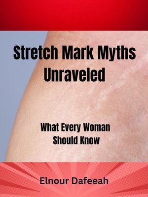 cover image of Stretch Marks Unraveled